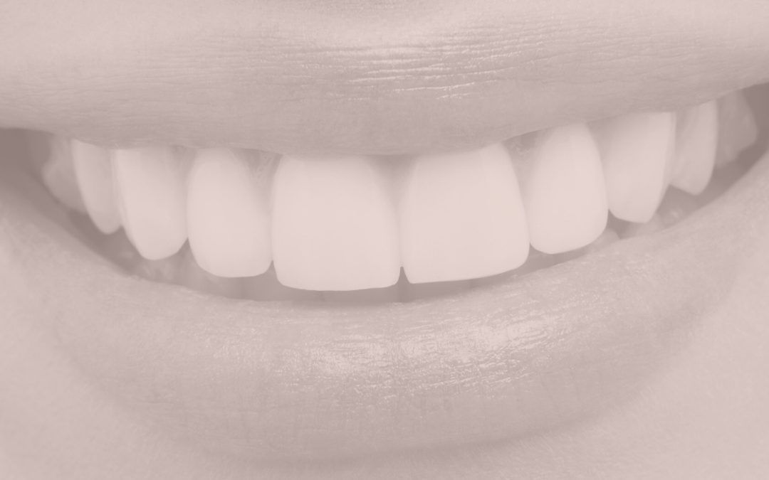 Estética dental, una cuestión de salud