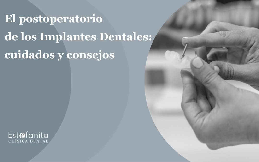El postoperatorio de los implantes dentales: cuidados y consejos.
