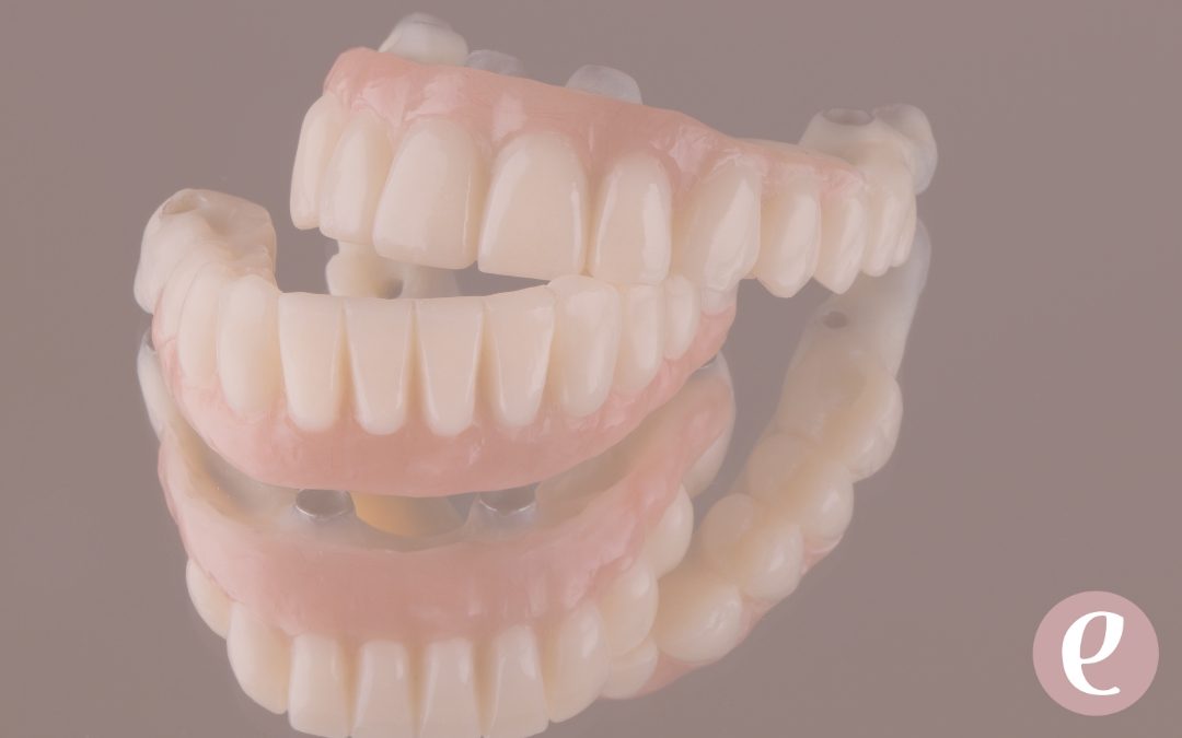 ¿Qué son las prótesis sobre implantes dentales?