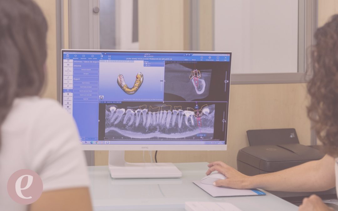 Qué es la cirugía oral guiada y en qué te beneficia