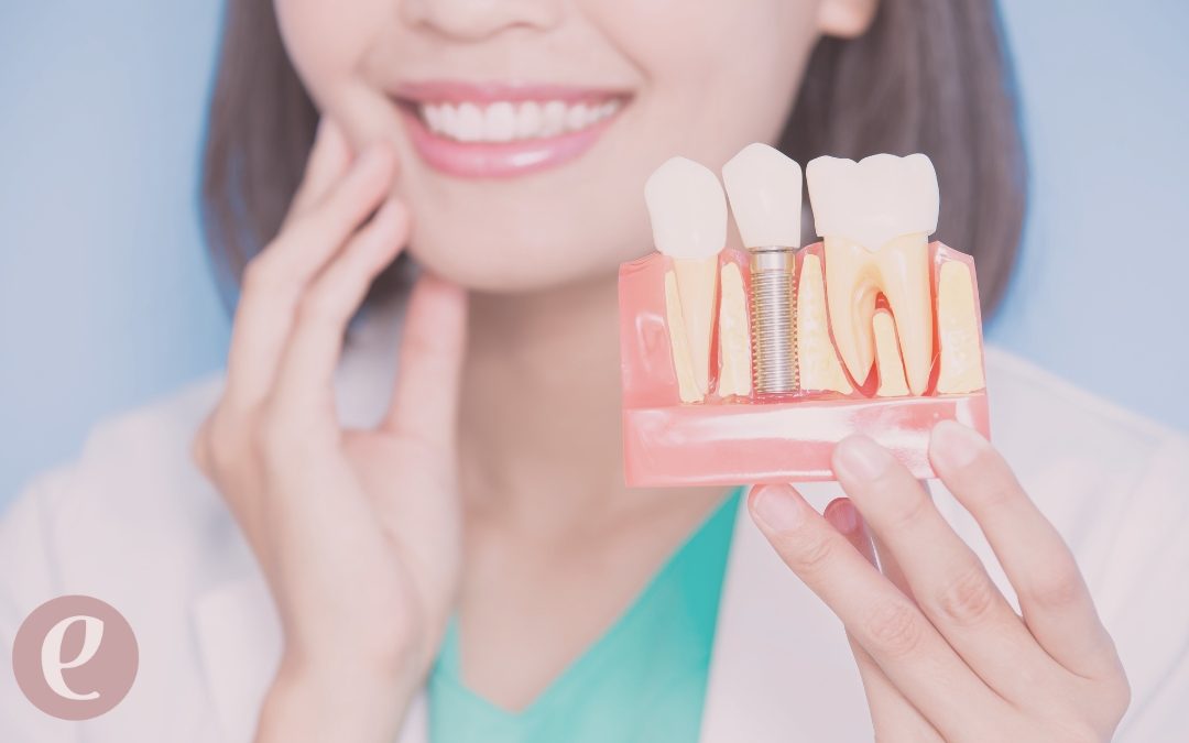 Cómo afectan las enfermedades periodontales a la colocación de implantes dentales