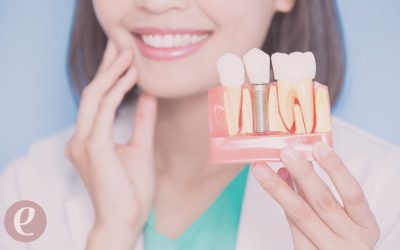 Cómo afectan las enfermedades periodontales a la colocación de implantes dentales