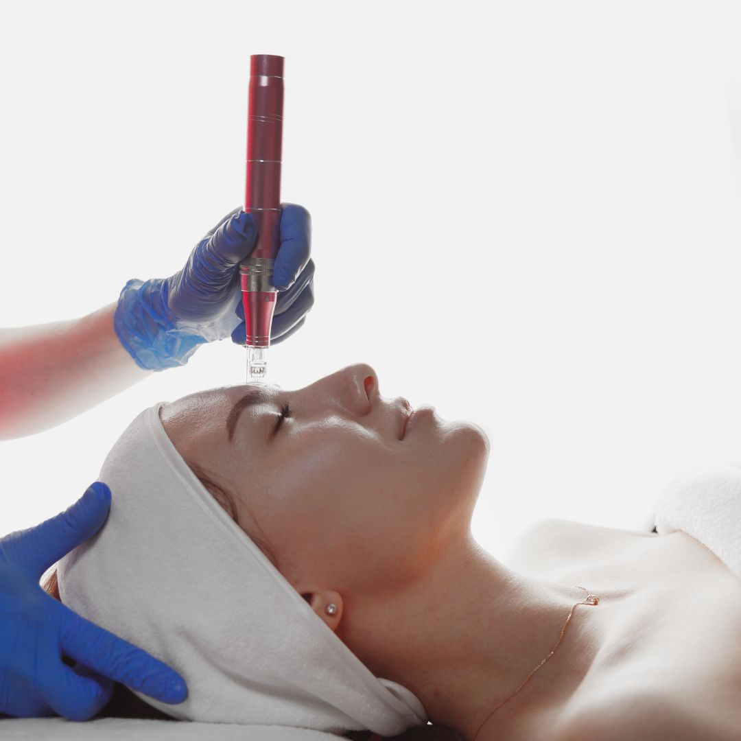dermapen facial