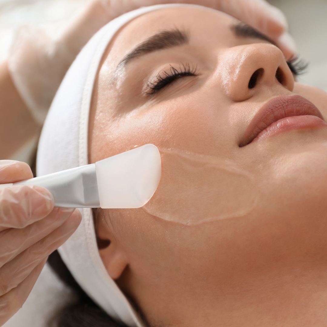 peeling en getafe