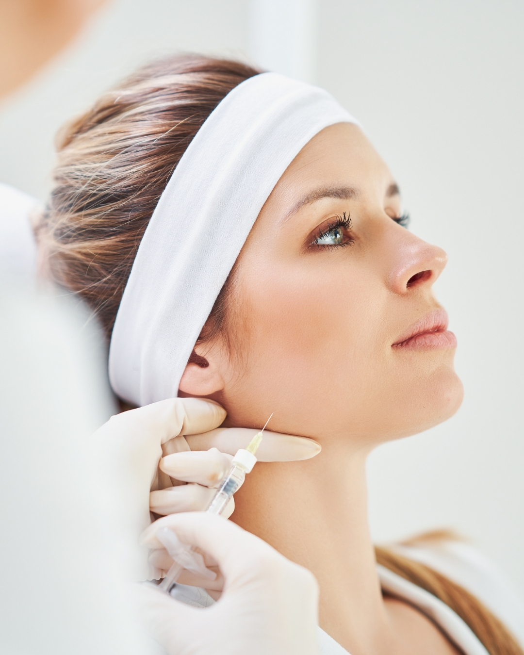 dermapen facial