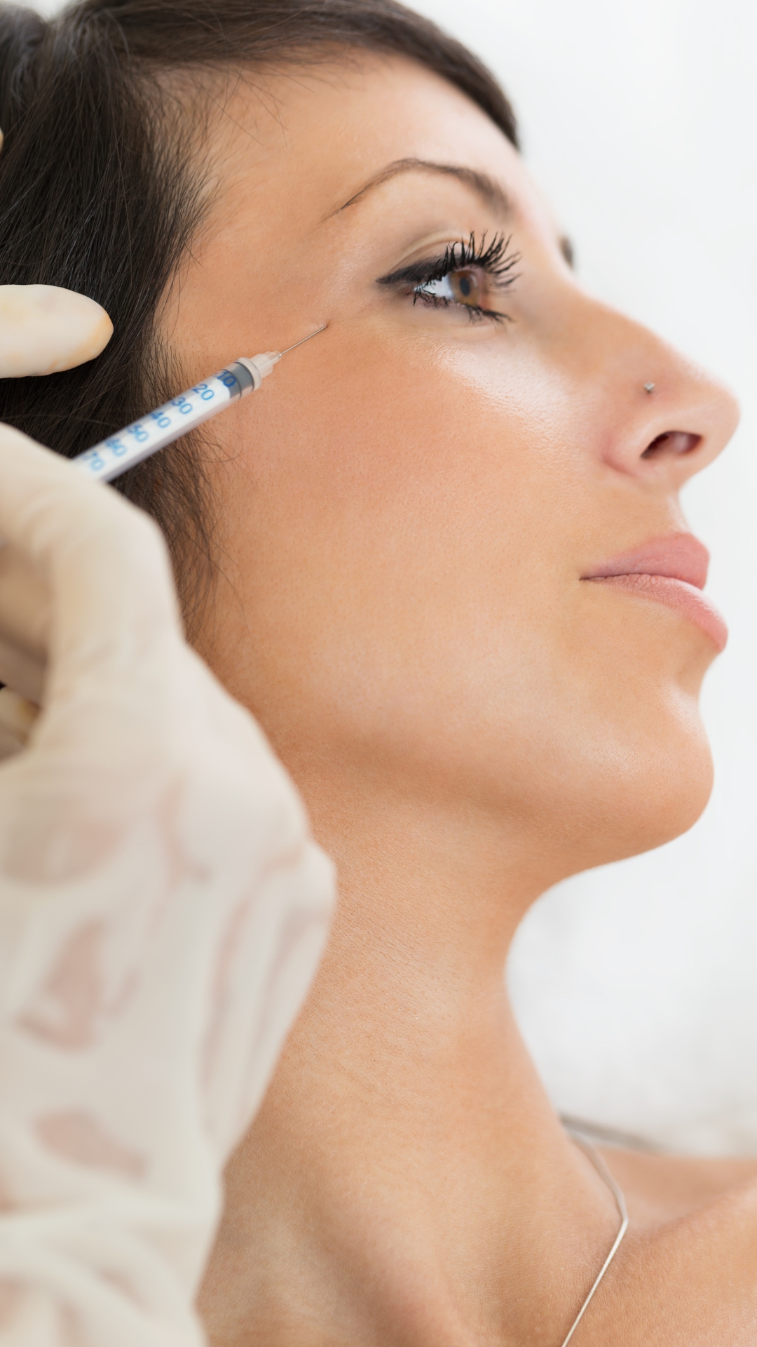 dermapen facial