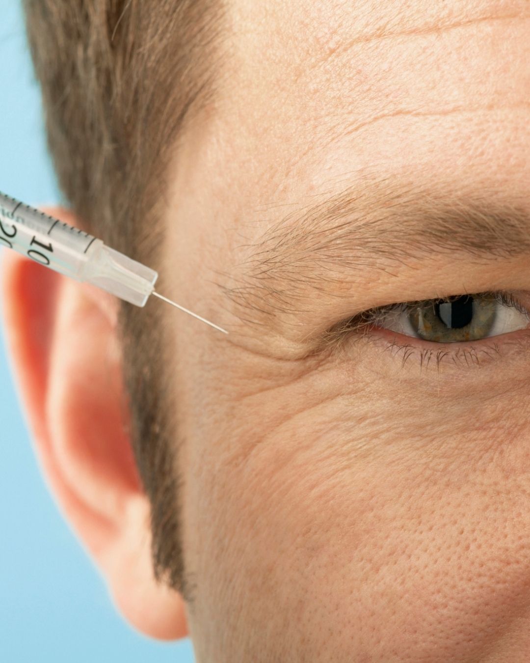 dermapen facial
