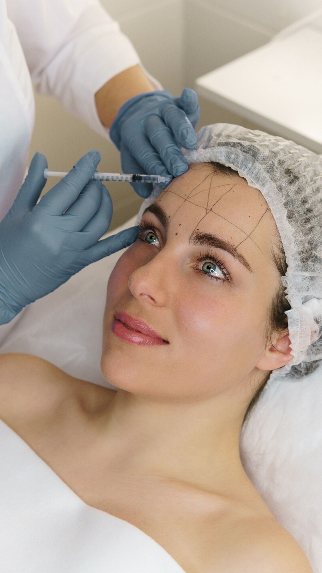 dermapen facial