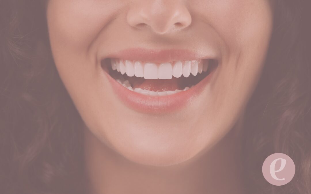 Carillas dentales: una solución estética, cómoda y a tu medida