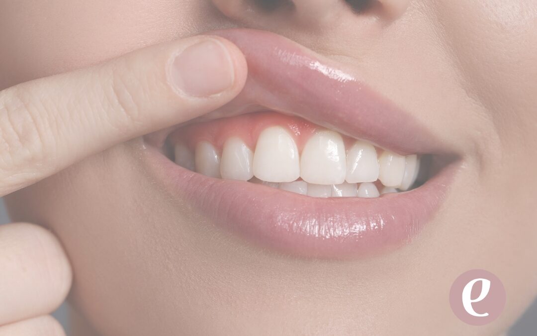 Cuidar tus encías es cuidar todo: prevención, cirugía guiada y equilibrio facial