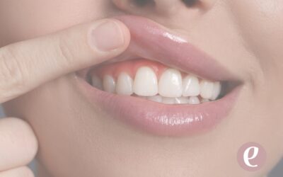 Cuidar tus encías es cuidar todo: prevención, cirugía guiada y equilibrio facial